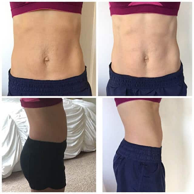 Nerium Night Cream, Firm Cream for Stretch Marks, Before and After